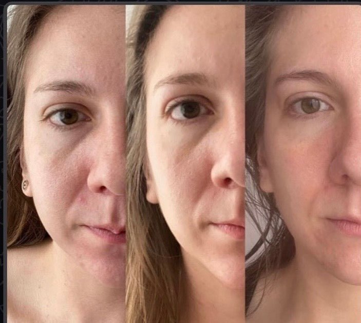 Curso Rejuvenecimiento facial total | Todos nuestros cursos - Facial Fitness