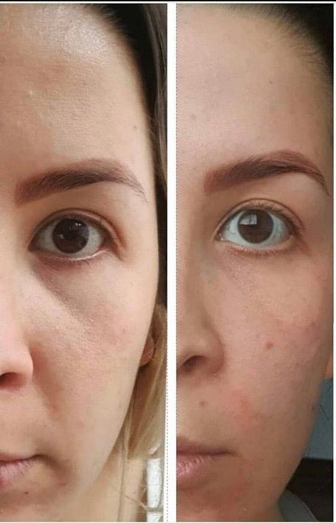 Curso Rejuvenecimiento facial total | Todos nuestros cursos - Facial Fitness