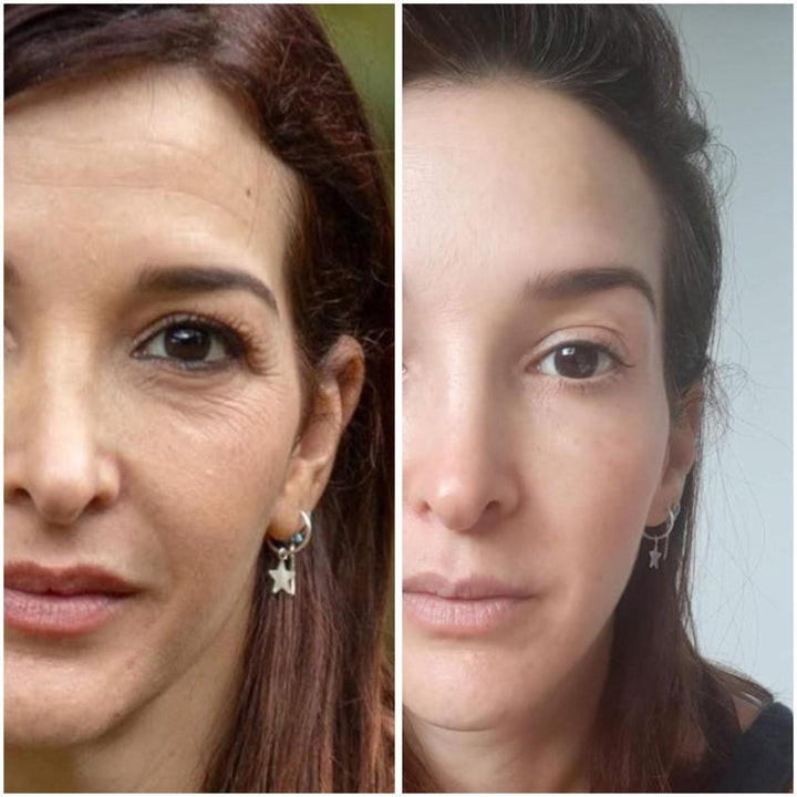 Curso Yoga Facial Presencial en Medellín - Facial Fitness